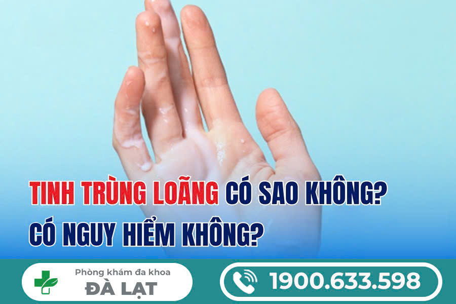 Hình ảnh minh họa